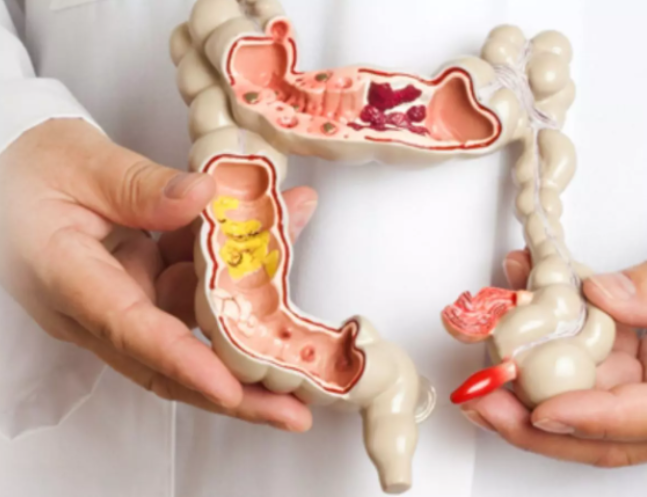 Appendicitis